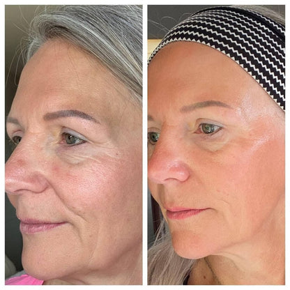 Ageoro Lymphatic Face Brush V2 Pro